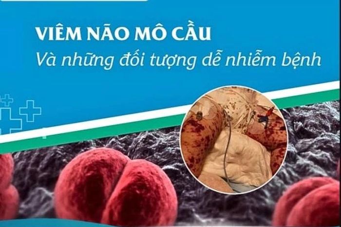 Viêm não mô cầu dấu hiệu giống cảm cúm, cách gì phân biệt? - Báo Tri thức &amp; Cuộc sống