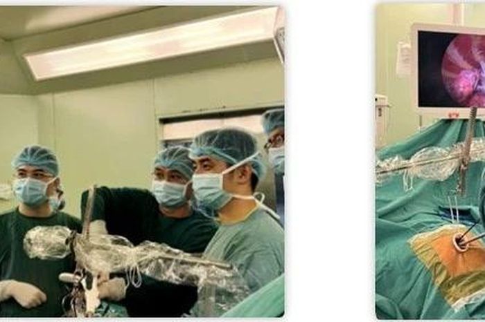 Bạch Mai triển khai mổ nội soi mới điều trị kén khí phổi - Báo Tri thức &amp; Cuộc sống