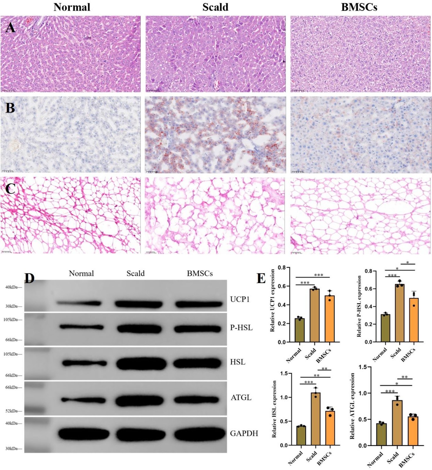 Bone marrow–derived mesenchymal stem cells alleviate hepatic lipid metabolism disorders after scald injury: integrating liver transcriptome and metabolome