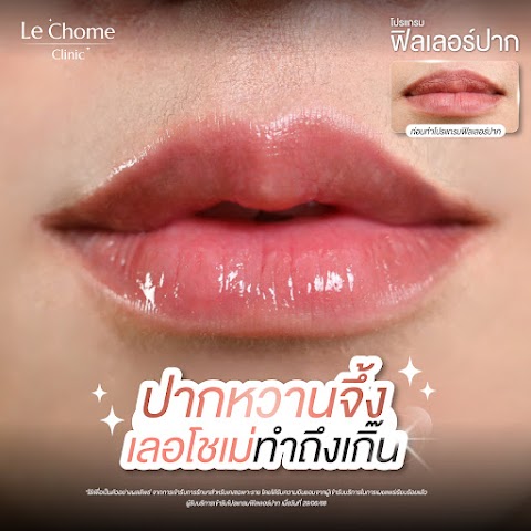 ฟิลเลอร์
