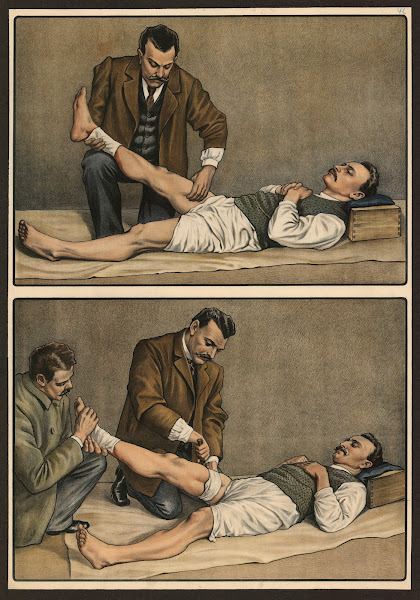Broken bones 1911