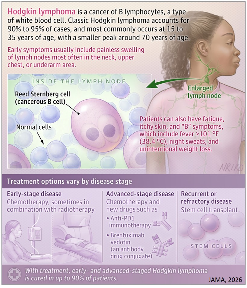 What Is Hodgkin Lymphoma?