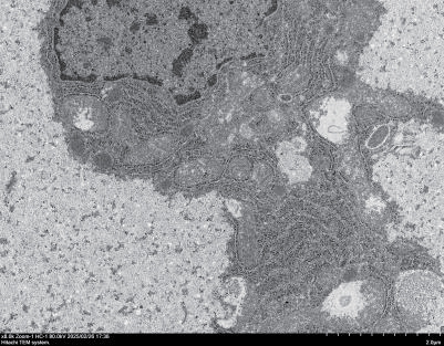 Vitamin D3 Supplementation on Antioxidant Capacity and Ferroptosis in Juvenile Gibel Carp (Carassius auratus gibelio var. CAS V) at Different Stocking Densities
