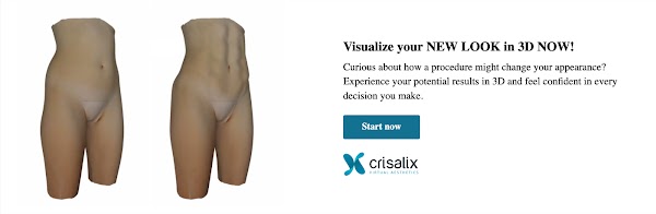 Bannière web Crisalix en ligne - Corps