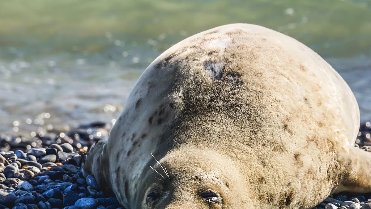 코골이 치료 방법별 장단점과 수술 전 고려사항