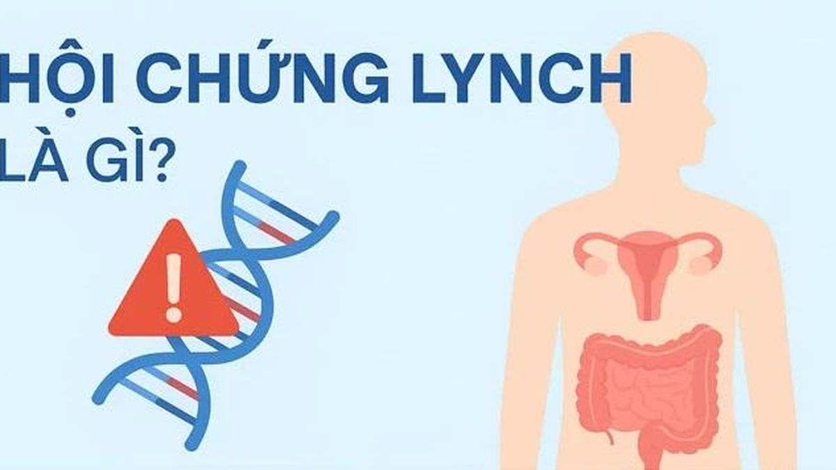 Phát hiện sớm hội chứng Lynch để ngăn ngừa ung thư - Báo Tri thức &amp; Cuộc sống