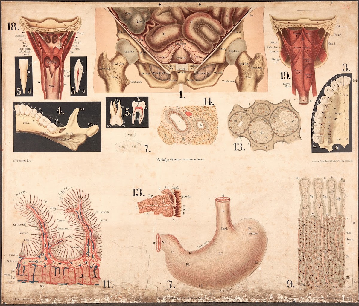 Posterior Abdominal Cavity Small Intestine Spleen Etc 1911