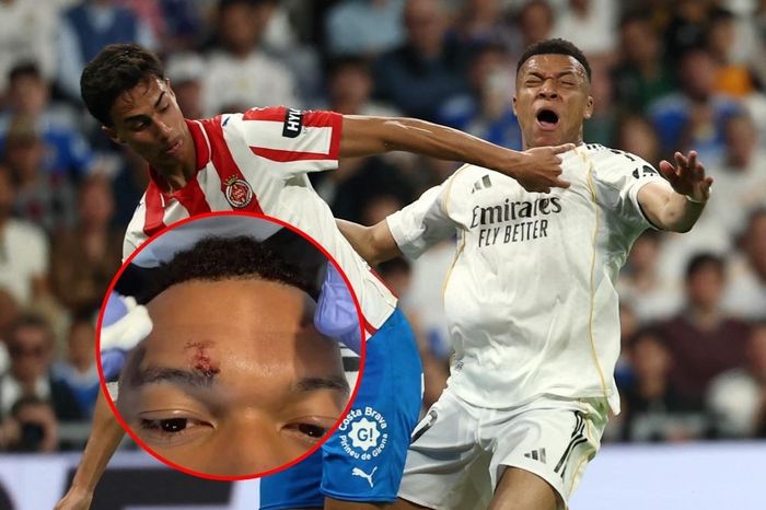 Mbappe gây lo lắng - Tạp chí Tri thức