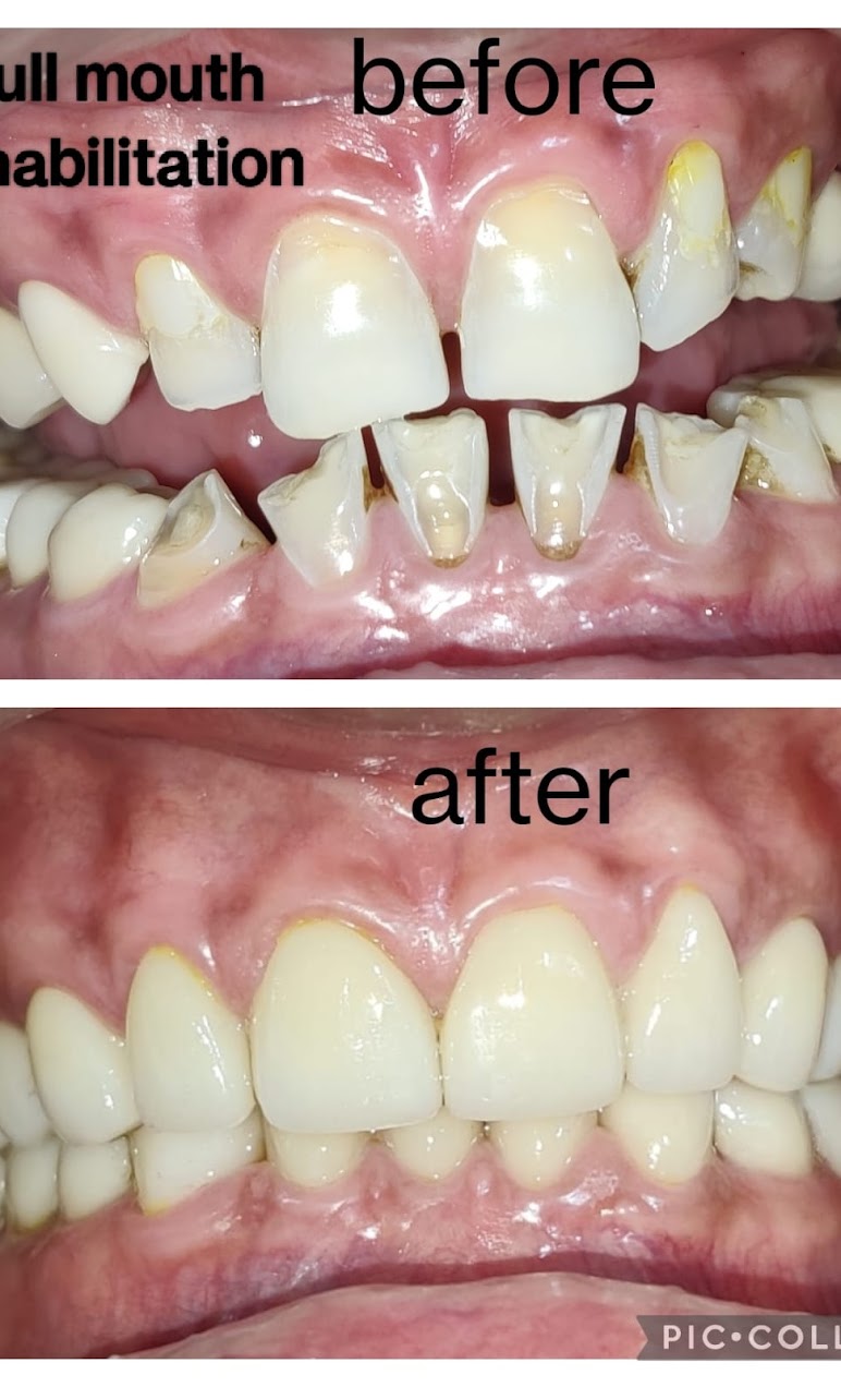 Patient Smile Transformation 3