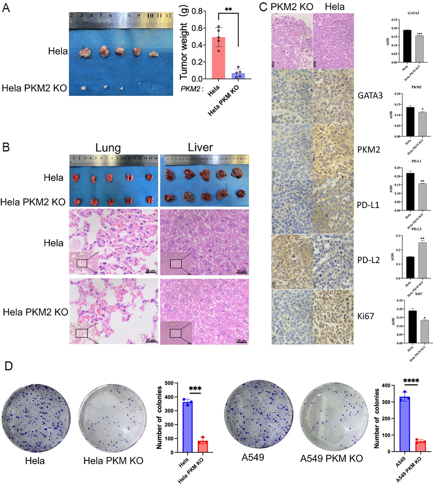Divergent roles of PKM2 in regulating PD-L1 and PD-L2 expression and their implications in human and mouse cancer models