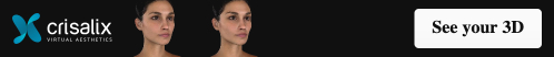 Bannière web Crisalix épinglée - Visage