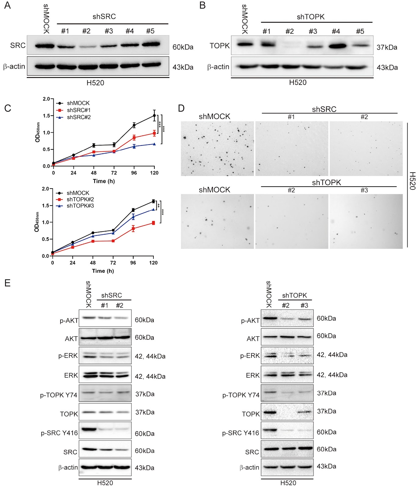 The SRC-TOPK positive feedback loop promotes RB1 phosphorylation and drives the development of lung squamous cell carcinoma