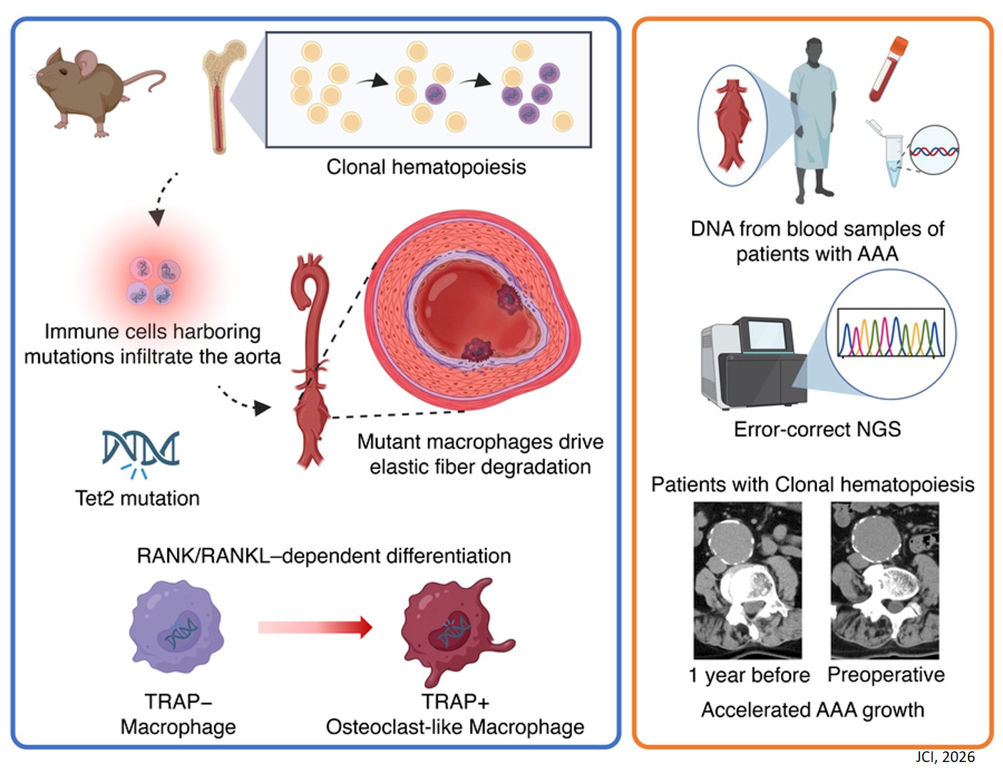 Tet2-driven clonal hematopoiesis drives aortic aneurysm via macrophage-to-osteoclast–like differentiation