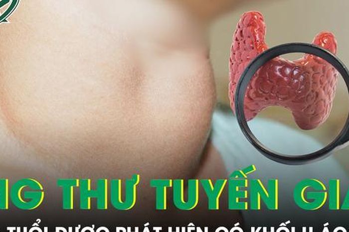 Bé 13 tuổi ung thư tuyến giáp, bác sĩ cảnh báo dấu hiệu dễ bỏ qua - Báo Sức Khỏe &amp; Đời Sống