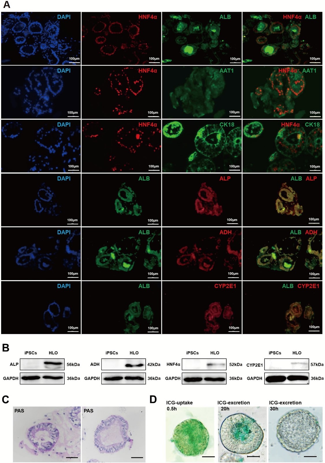 Development of an alcoholic liver disease model for drug evaluation from human induced pluripotent stem cell-derived liver organoids