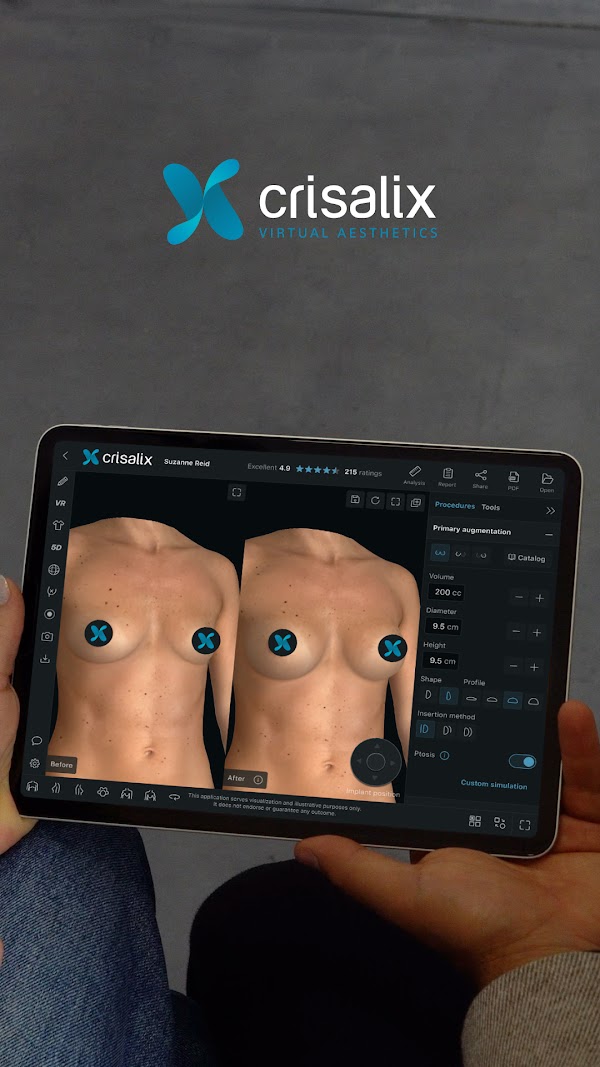 Un médecin montrant à une patiente une simulation mammaire 3D sur une tablette lors d’une consultation en chirurgie esthétique avec Crisalix. 1080px x 1920px.