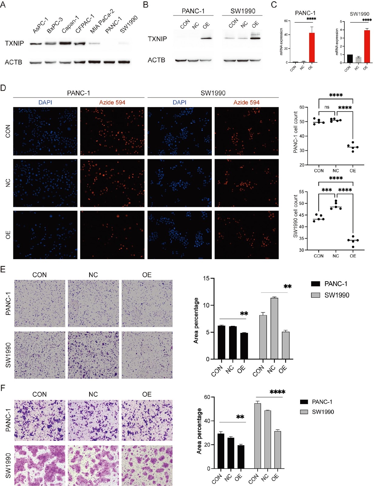Suppression of pancreatic cancer proliferation through TXNIP-mediated inhibition of the MAPK signaling pathway