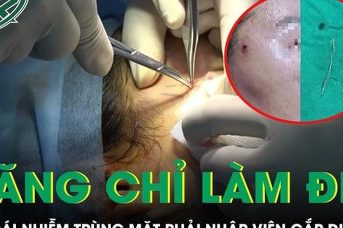 Căng chỉ làm đẹp tại spa cô gái trẻ nhiễm trùng mặt phải nhập viện gắp dị vật - Báo Sức Khỏe &amp; Đời Sống