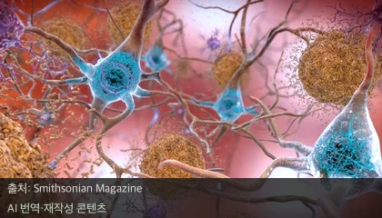 알츠하이머 신약 - 알츠하이머 신약, 타우 단백질 제어해 인지 저하 늦춘다
