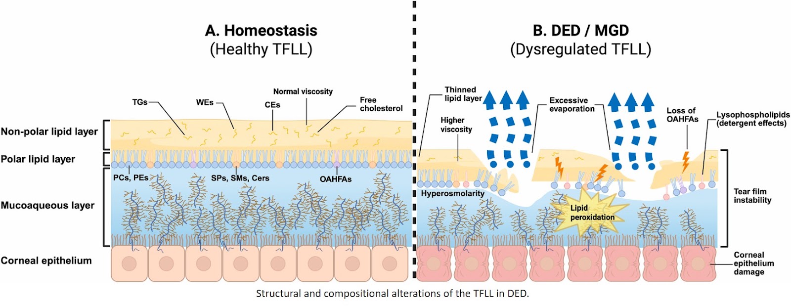 Dysregulated lipid metabolism in dry eye disease: Pathophysiological mechanisms and emerging treatments