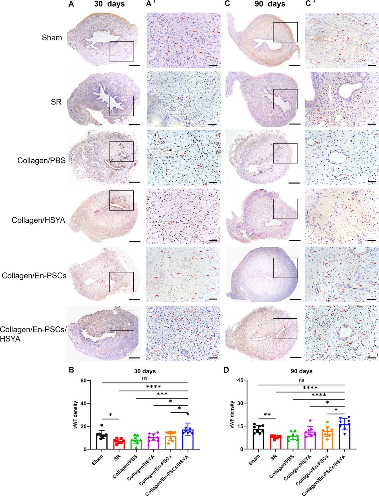 Transplantation of human endometrial perivascular stem cells with hydroxy saffron yellow A promotes uterine repair in rats