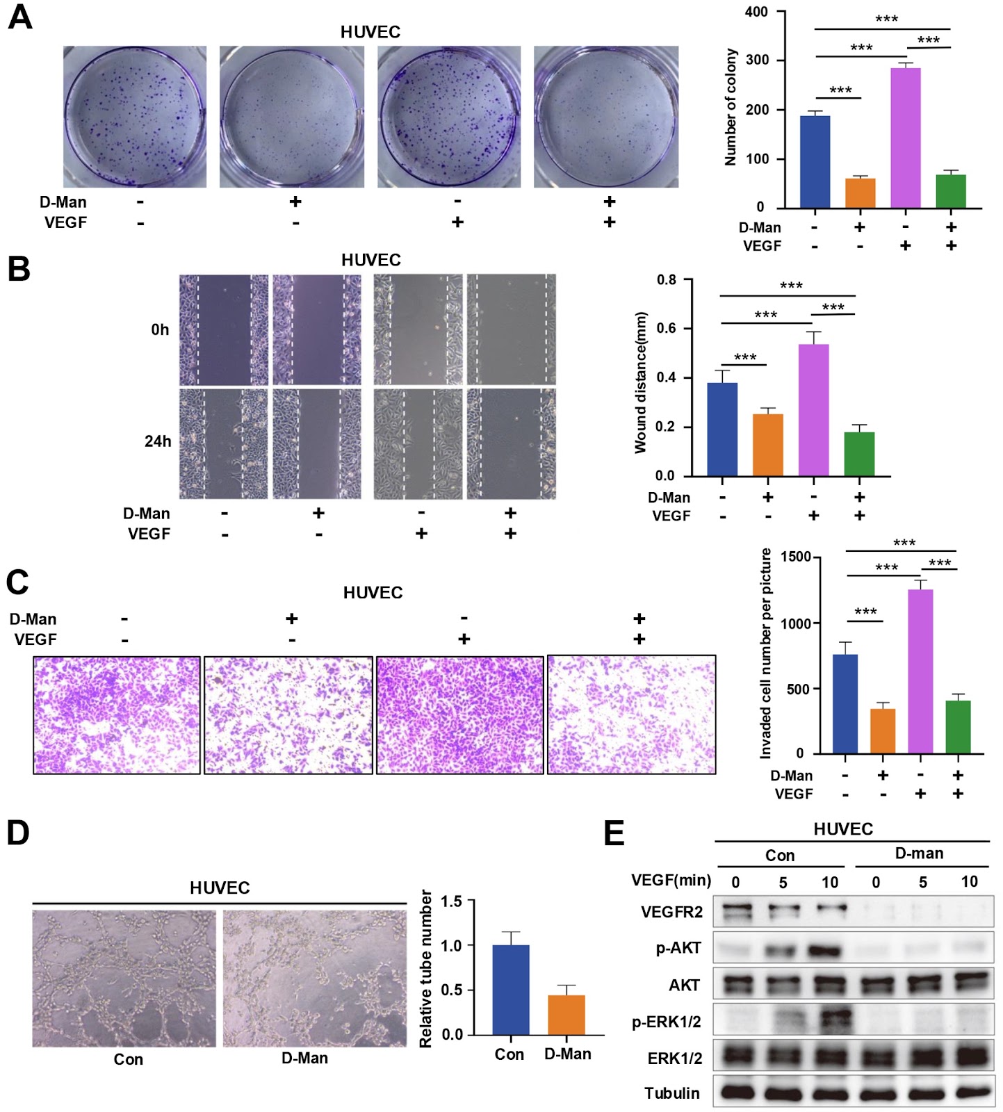 D-mannose suppresses the angiogenesis and progression of colorectal cancer