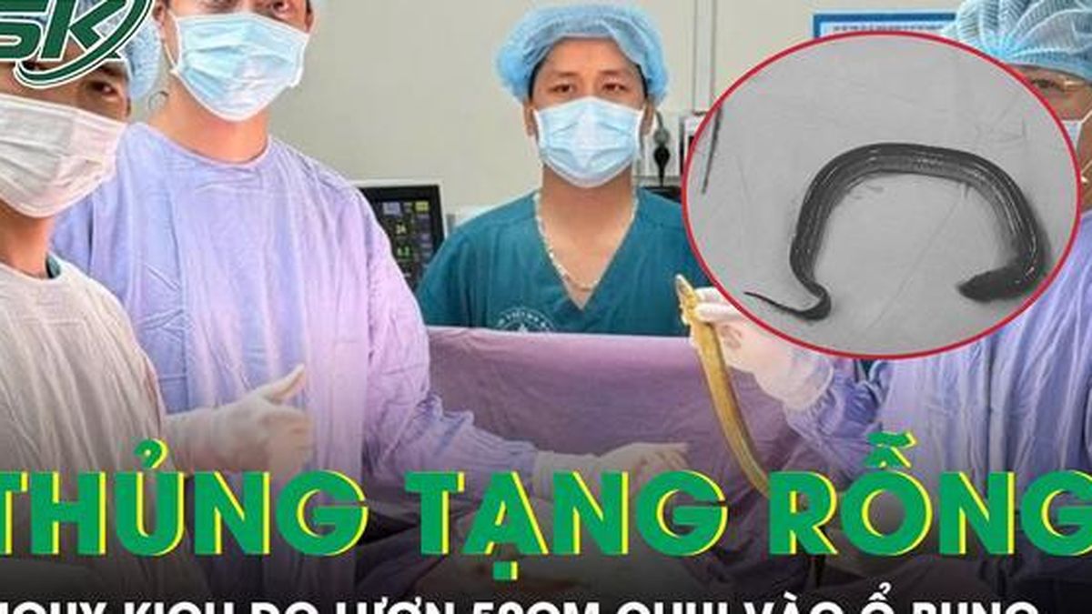 Người đàn ông thủng tạng rỗng do con lươn dài 50cm chui vào ổ bụng - Báo Sức Khỏe &amp; Đời Sống