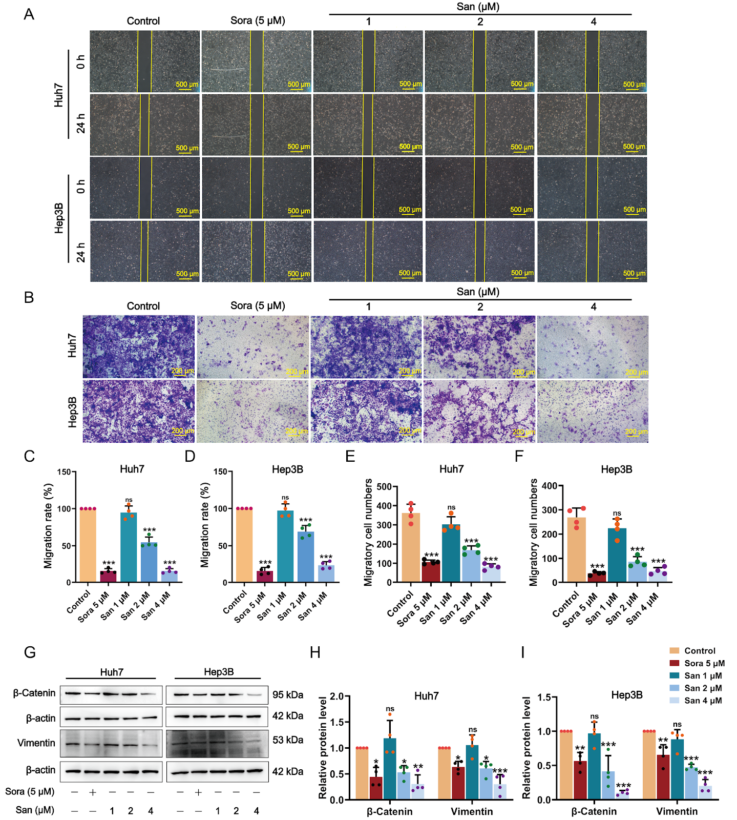 Sanguinarine exerts anti-hepatocellular carcinoma activity by targeting FDX1 to induce FDX1/LIAS/DLAT/HSP70 axis-dependent cuproptosis