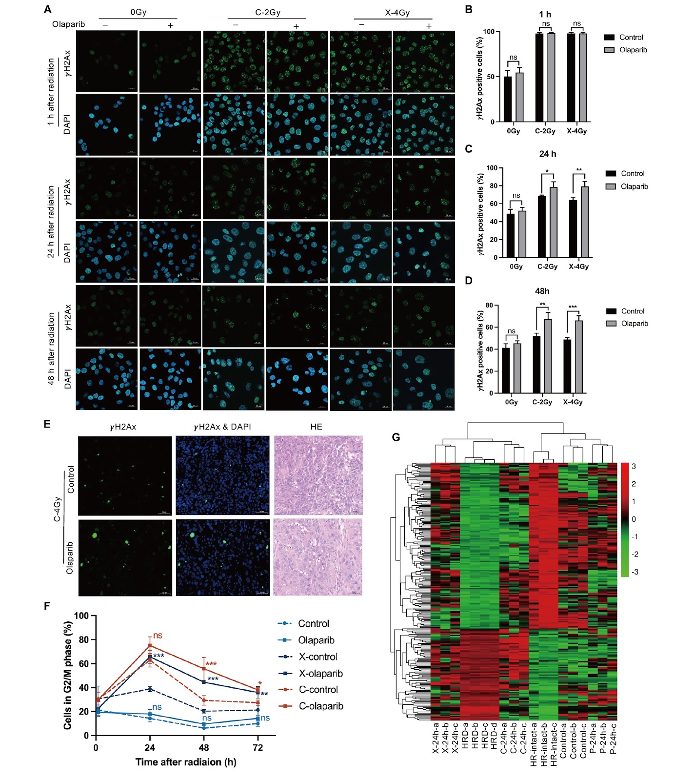 Autophagy-dependent sensitization effects of PARP inhibitors on recurrent nasopharyngeal carcinoma treated with carbon ion and photon irradiation