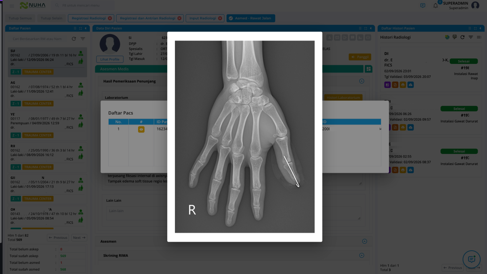 Tampilan fitur Hasil Pemeriksaan Terintegrasi ke Asesmen Pasien pada Modul Radiologi NUHA