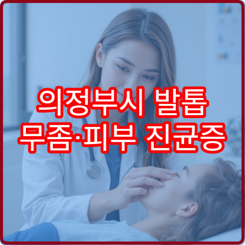 의정부시 발톱 무좀·피부 진균증 치료 가능한 병원 정보