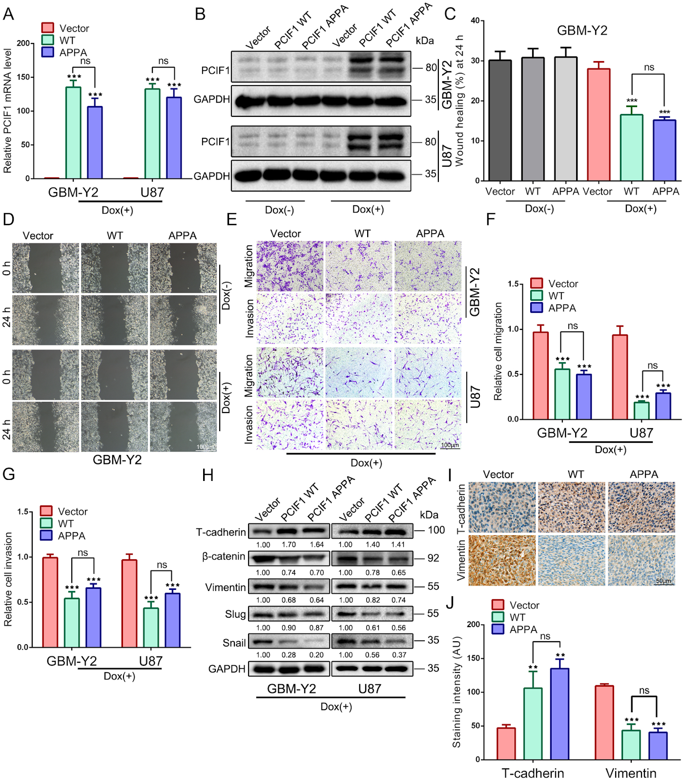 PCIF1 Modulates Glioblastoma Cell Migration and Invasion by Altering PI(3,4)P2 Levels through the PI5-Phosphatase INPP5B