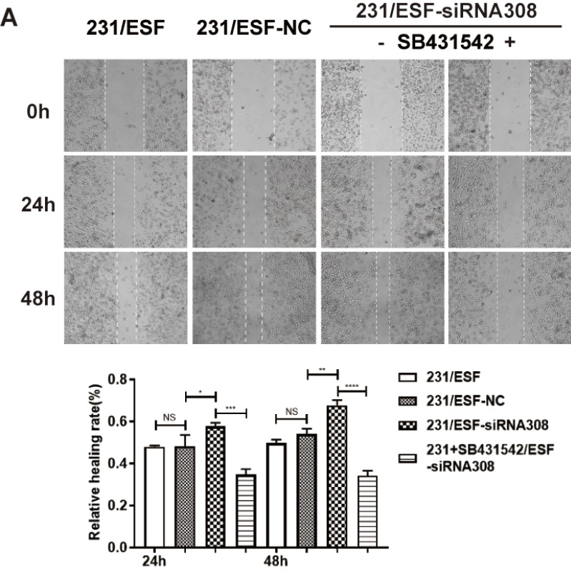 Caveolin-1-deficient fibroblasts promote migration, invasion, and stemness by activating the TGF-β/Smad signaling pathway in breast cancer cells