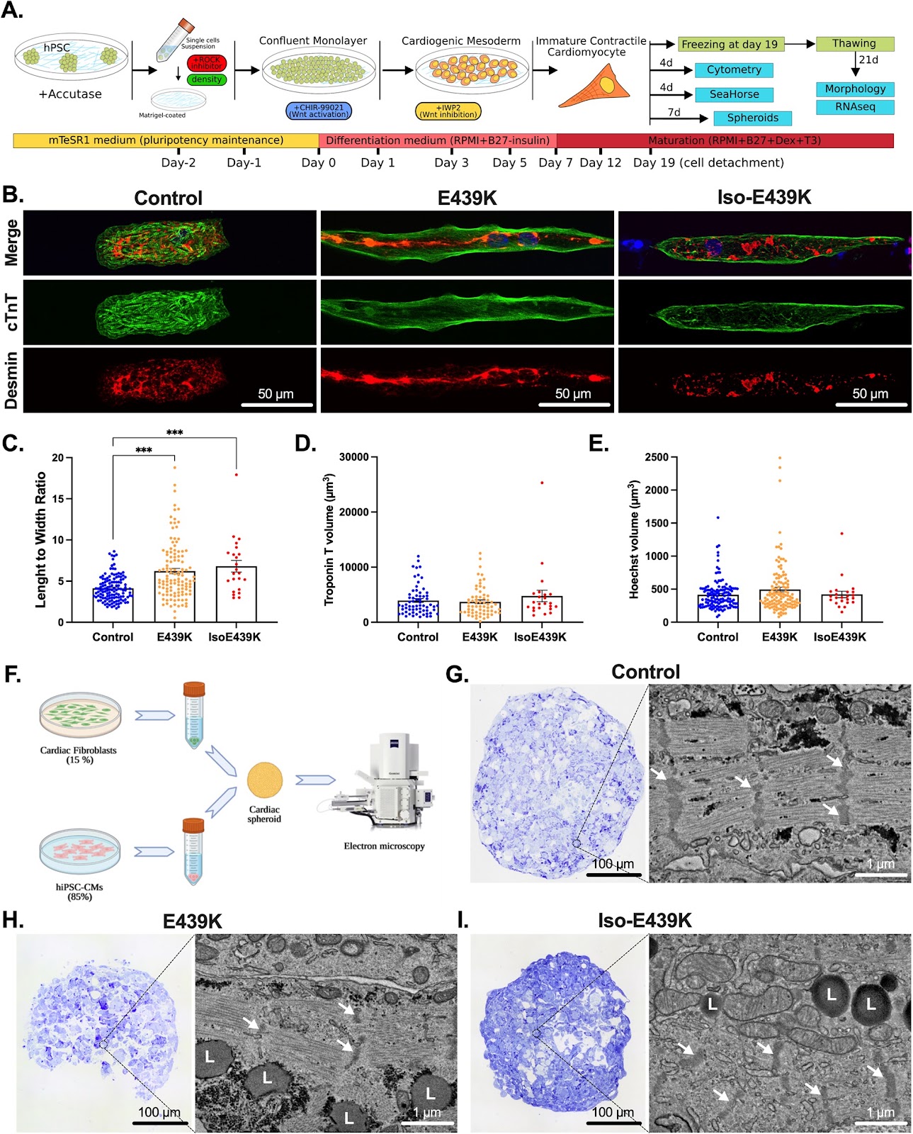 Critical contribution of mitochondria in the development of cardiomyopathy linked to desmin mutation