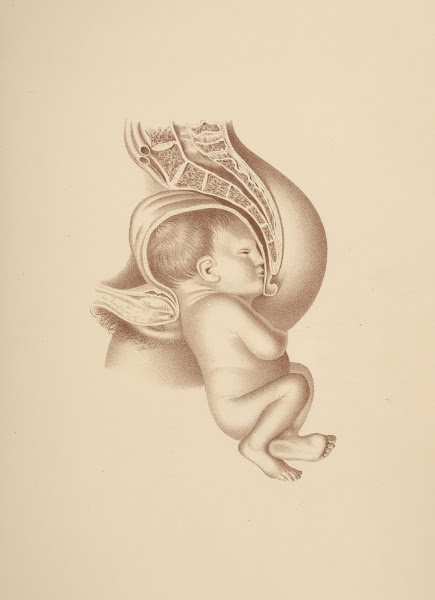 Mechanism of Natural Labor in the First Position of the Breech Left Sacro iliac