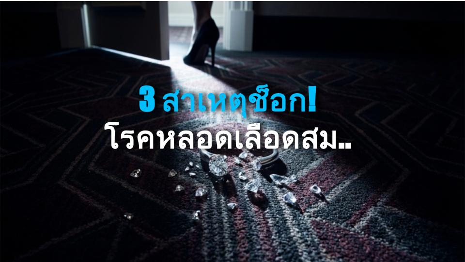 3 สาเหตุช็อก! โรคหลอดเลือดสมองที่คุณไม่รู้!