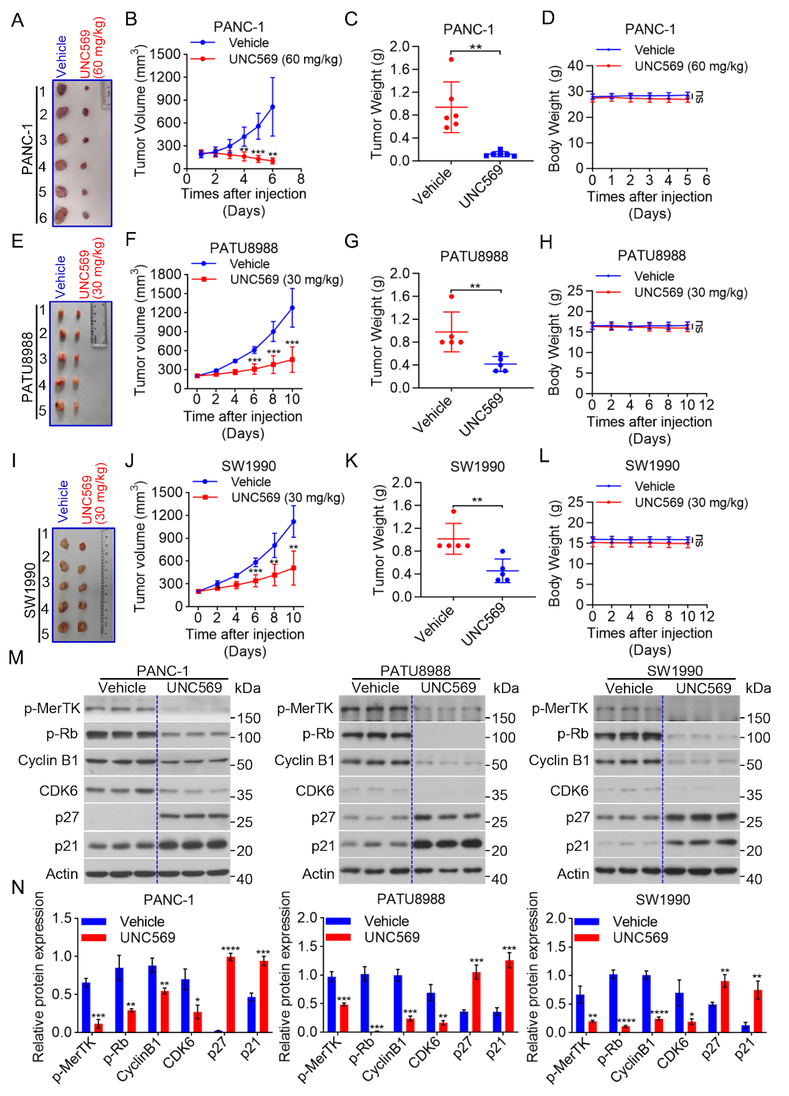 MerTK inhibition by UNC569 triggers DNA damage and JNK/p38 MAPK cascade-driven apoptosis in pancreatic cancer