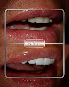 Dr Habib Zarifeh best dentist Lebanon ISO 9001 Smile Infinity Jounieh 2026