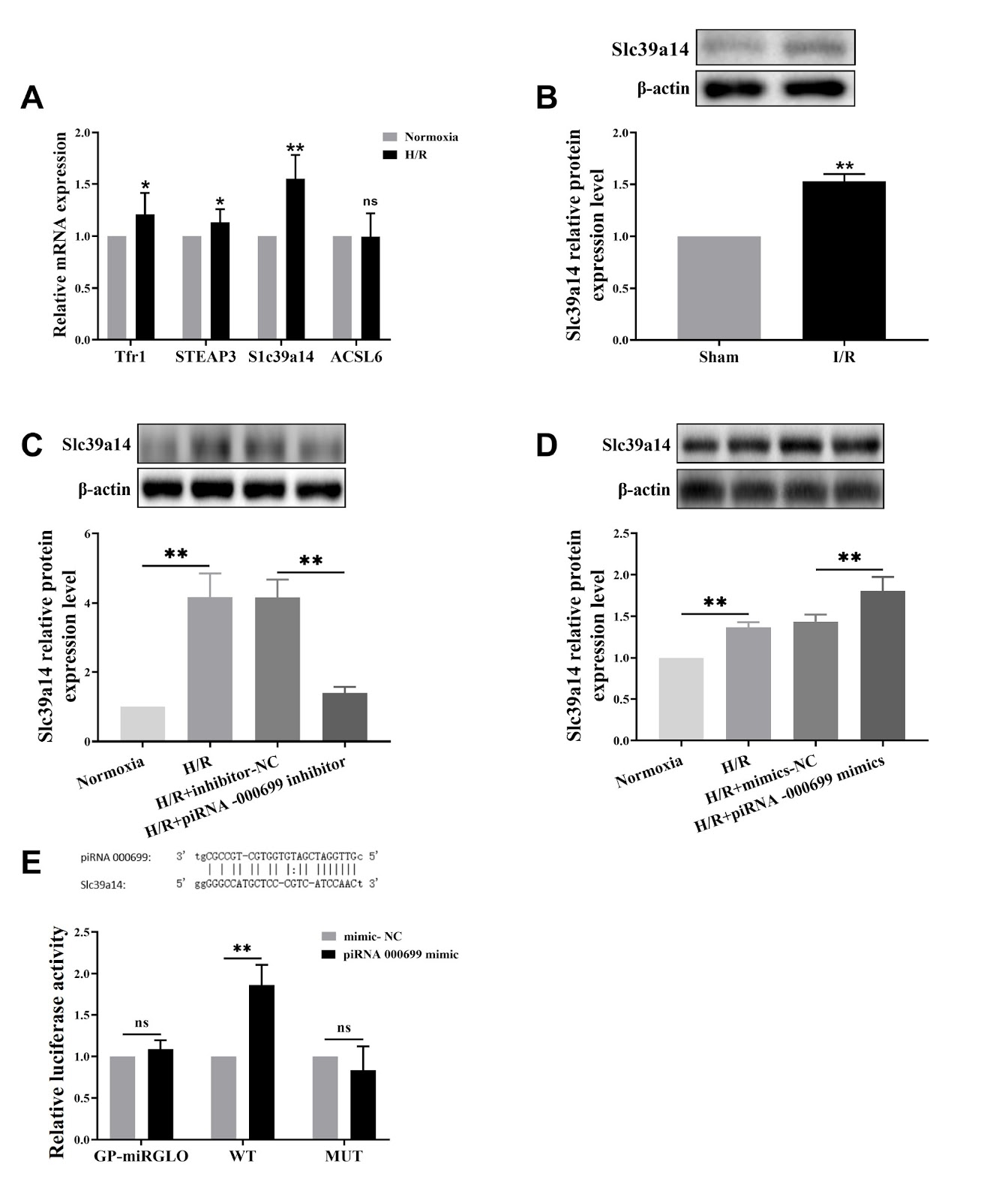 The mechanism by which piR-000699 targets SLC39A14 regulates ferroptosis in aging myocardial ischemia/reperfusion injury