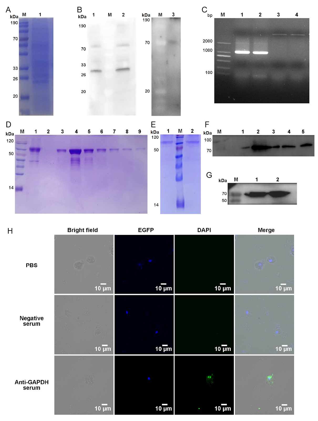 Development of a Colloidal Gold Immunochromatographic Strip Based on GAPDH for Pentatrichomonas hominis in Dogs