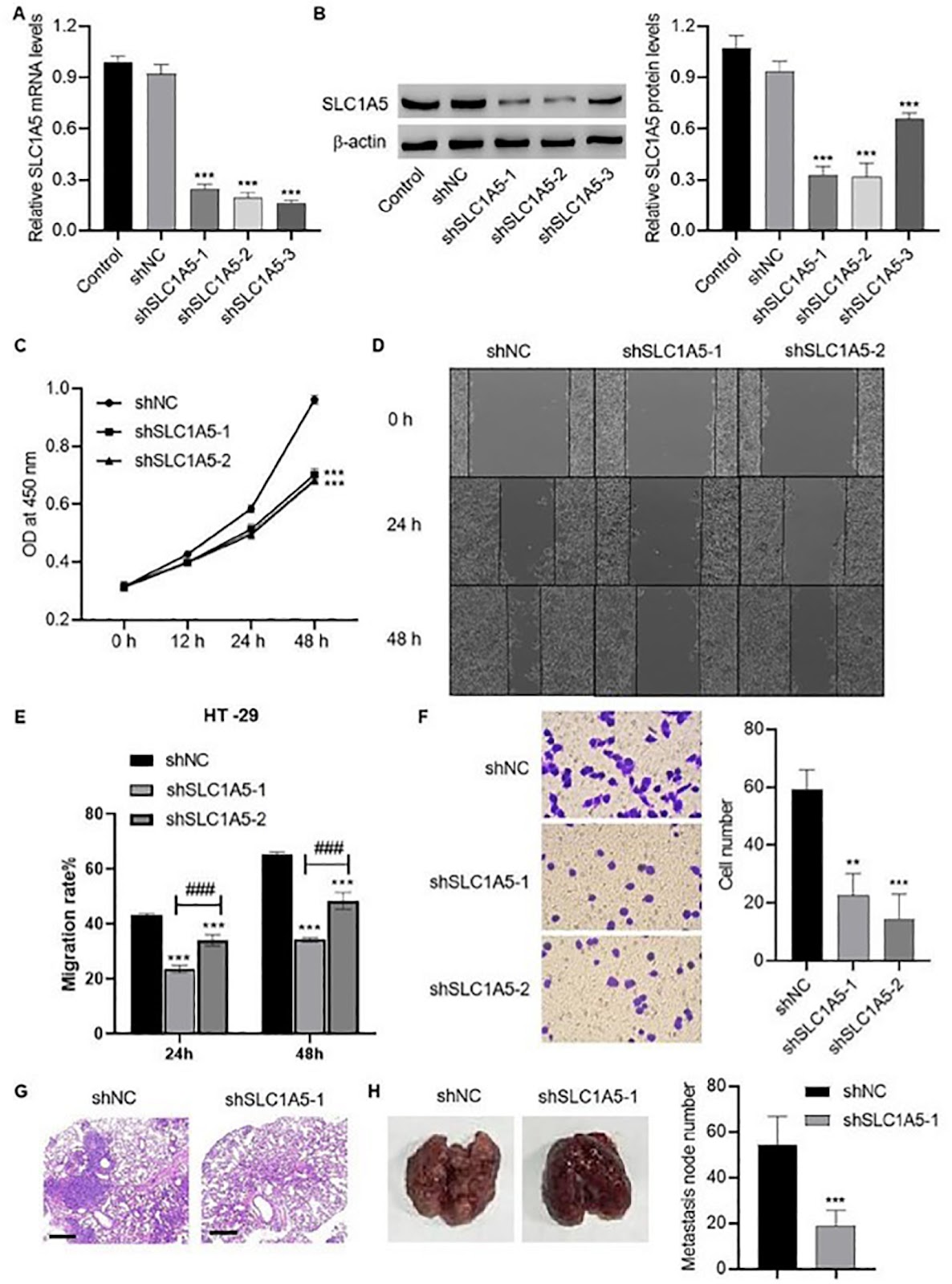 ATF4 promotes glutaminolysis and glycolysis in colorectal cancer by transcriptionally inducing SLC1A5