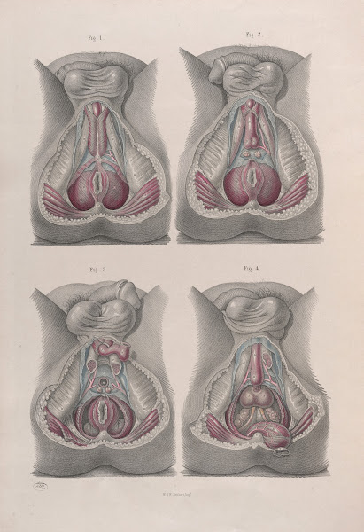 Surgical anatomy Pl43 1856