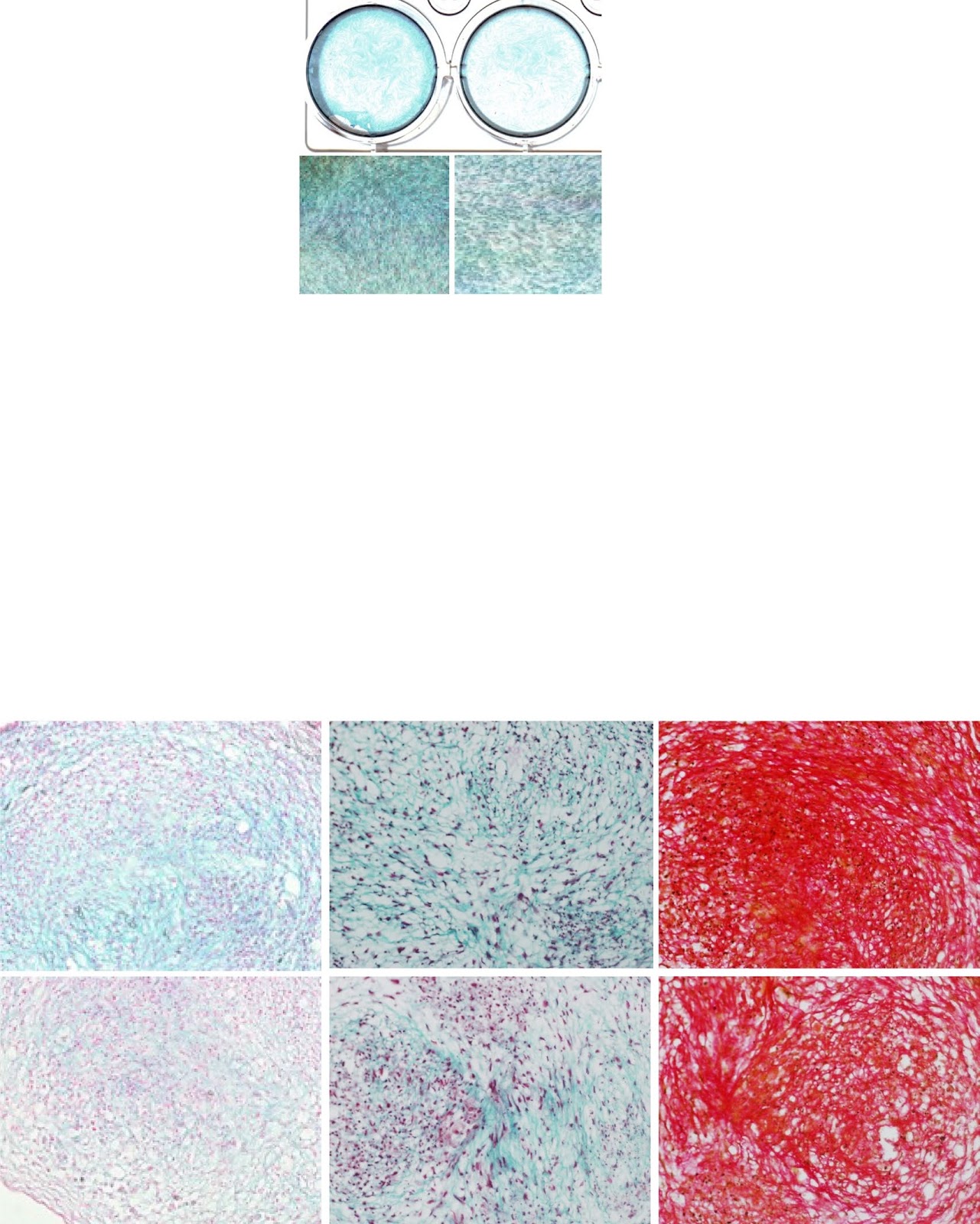 LncRNA SNHG1 enhances cartilage regeneration by modulating chondrogenic differentiation and angiogenesis potentials of JBMMSCs via mitochondrial function regulation