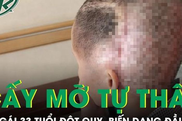 Cấy mỡ tự thân, cô gái 33 tuổi đột quỵ, biến dạng đầu - Báo Sức Khỏe &amp; Đời Sống