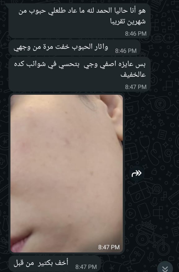 تقييم عميلة