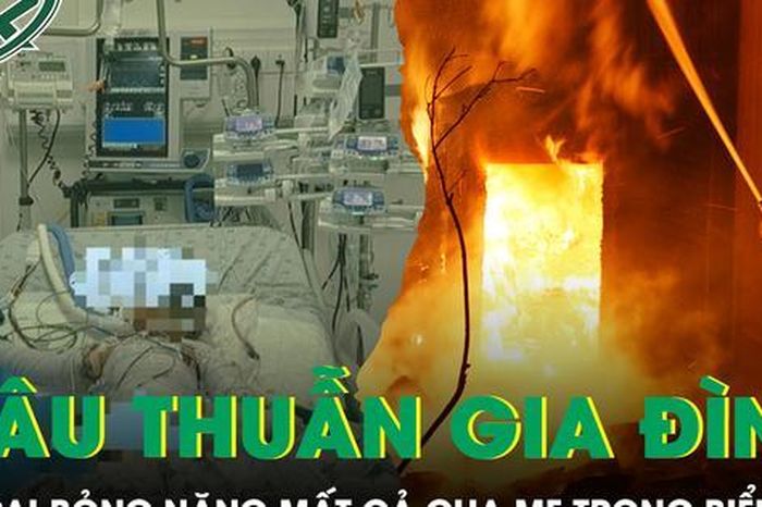 Căn nhà chìm trong biển lửa sau mâu thuẫn gia đình, bé 4 tuổi bỏng hơn 90% cơ thể - Báo Sức Khỏe &amp; Đời Sống