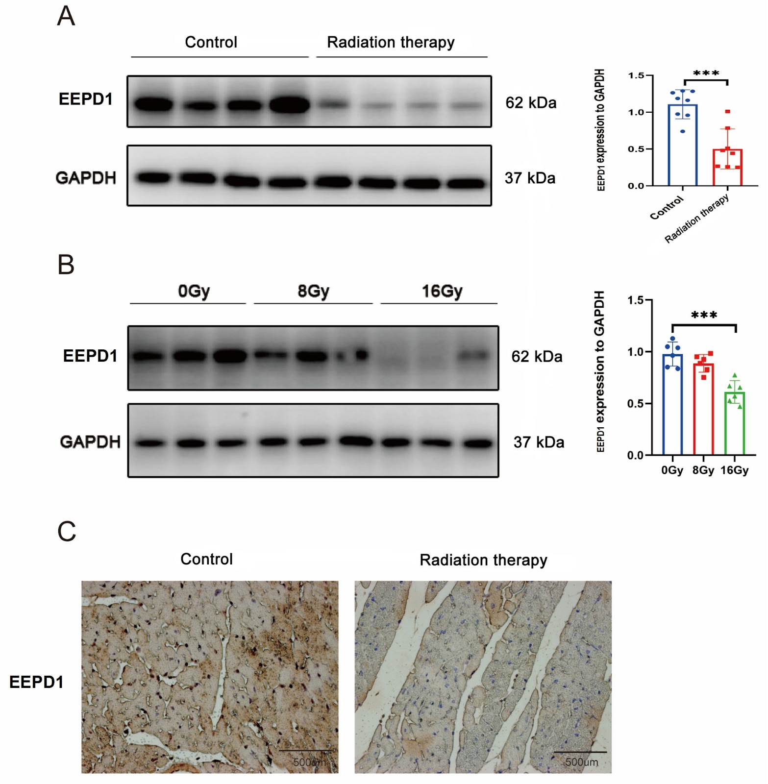 EEPD1 attenuates radiation-induced cardiac hypertrophy and apoptosis by degrading FOXO3A in cardiomyocytes
