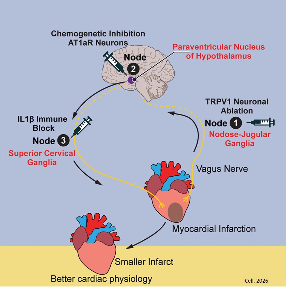 A triple-node heart-brain neuroimmune loop underlying myocardial infarction