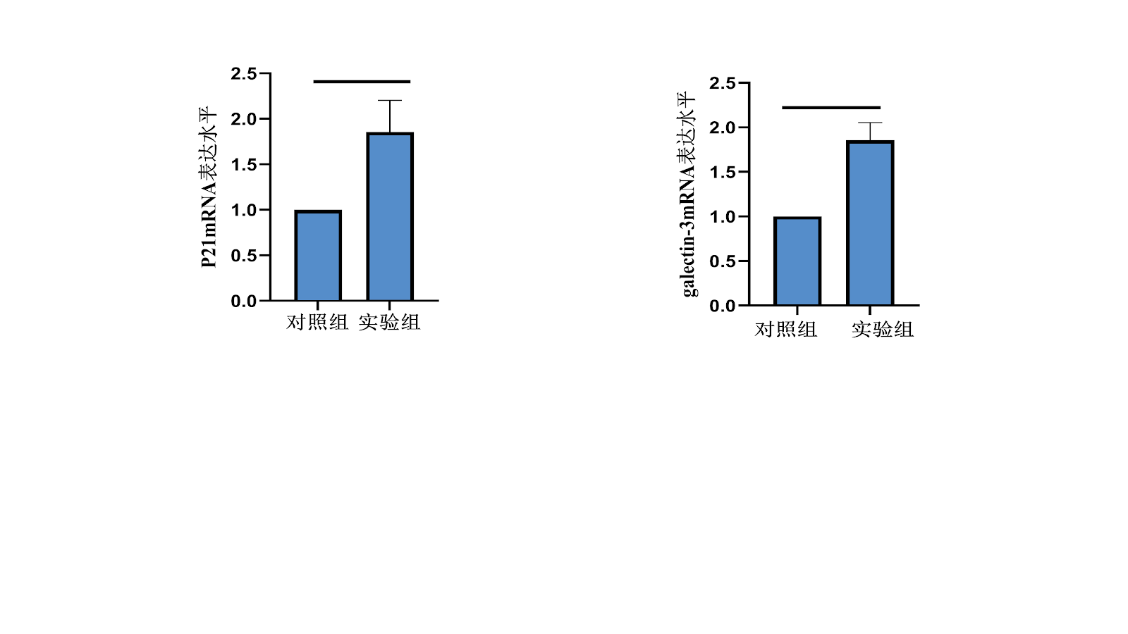 Senescent bone marrow mesenchymal stem cells promote multiple myeloma cell proliferation through galectin-3