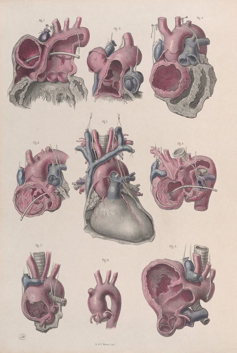 Surgical anatomy Pl14 1856